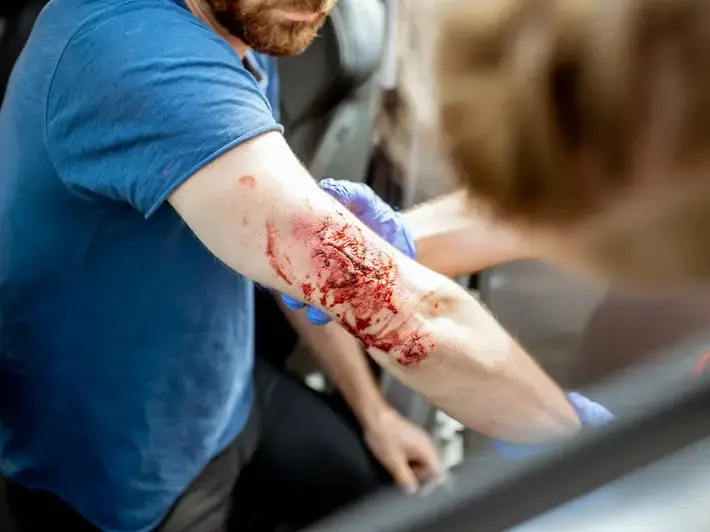 Trusted DUI Victim Consultation in San Tan Valley for Fast, Local Support